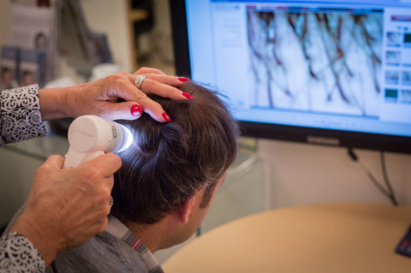 Bilan préalable en vue d'une greffe de cheveux