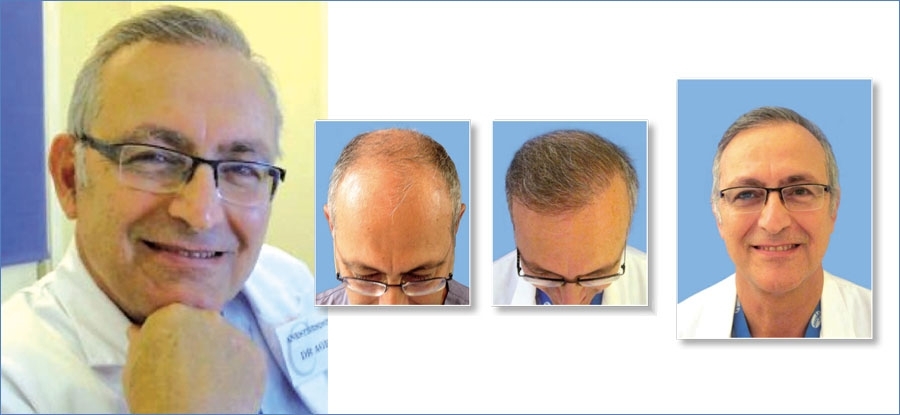 Abdul, 64 ans Abdul, 64 ans