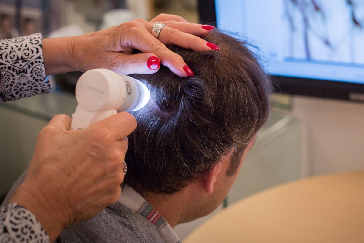 Diagnostic de la zone donneuse en vue d'une greffe de cheveux Diagnostic de la zone donneuse en vue d'une greffe de cheveux