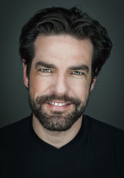 Greffe de barbe par technique FUE Ultra Greffe de barbe par technique FUE Ultra